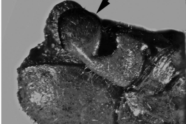 Male cerci,lateral view. Bardi et al. 2010