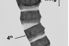 microphotografía exuvia de pupa