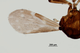 photomicrograph wing adult female  