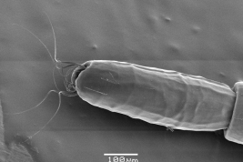 microfotografía MEB Segmento Caudal de la larva