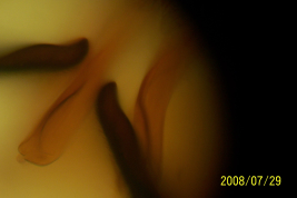 detalle de la genitalia, parámeros (BMNH)