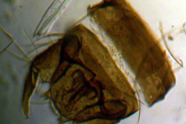Holotipo macho, microfotografía genitalia, preparado microscópico (BMNH)