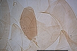 micrografías del órgano respiratorio  y setas pupa hembra