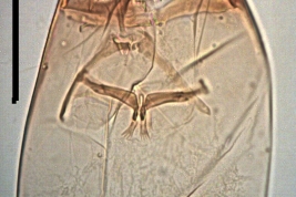 microfotografía Cápsula Cefálica (HC) detalles  aparato faringeo larva hembra