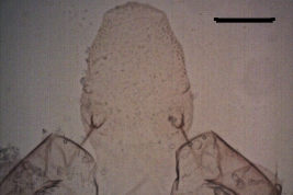 microfotografía de apotoma dorsal (DA) pupa  hembra