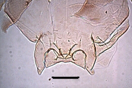 photomicrographs pupa: mouthparts and setae  