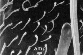 MEB 3r flagelomero con sensila ampulacea