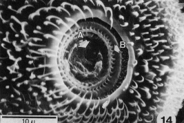 MEB órgano de Johnston, radial distribución de los scolopodium