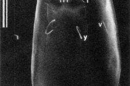 microfotografía MEB Capsula Cefálica  larva vista ventral