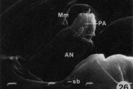 microfotografía MEB larva antena  y mandíbula detalles