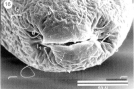 SEM larva Caudal Segment