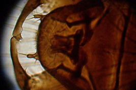 Holotipo, microfotografía genitalia macho (BMNH)