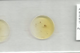 preparado microcópico Material de Colección hembra con exuvia de pupa