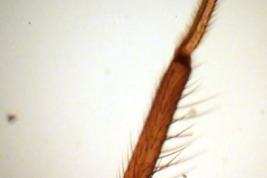 Allotype female, leg (BMNH)