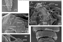 microfotografías   MEB detalles de pupa 