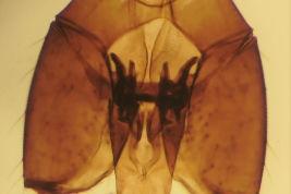 genitalia macho (MLPA)