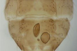 tip of female abdomen (MLPA)