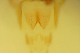 extremo abdomen hembra (MLPA)
