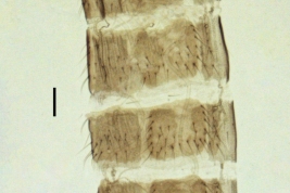 abdomen hembra (Anjos Dos Santos et al., 2017)