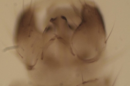 male genitalia, ventral view