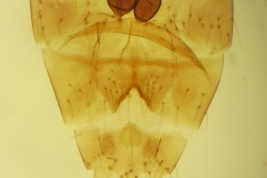 female abdomen (MLPA)