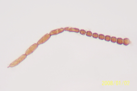 microfotografía antena adulto hembra  (BMNH)