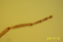 microfotografía adulto hembra tarsómeros  (BMNH)