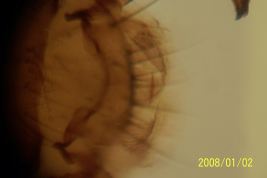 microfotografía adulto macho parameros y edeago  (BMNH)