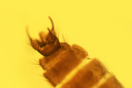 photomicrograph adult female  (BMNH)