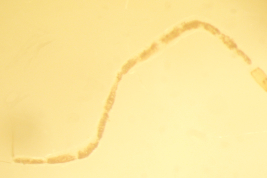 fotomicrografía larva entera