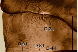 fotomicrografía pupa: 35, metathorax y  primer segmento  abdominal  chaetotaxia (vista dorsal y ventral);