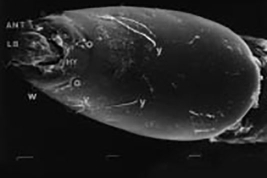 MEB cápsula cefálica vista ventral (chaetotaxia)