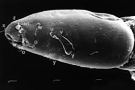 MEB cápsula cefálica vista lateroventral (chaetotaxia)