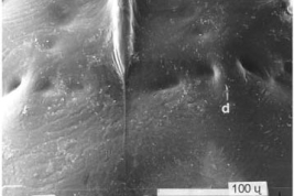 SEM female pupa cephalothoraxic tubercles (dorsal view)