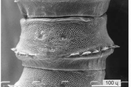 SEM female pupa 4th abdominal segment (dorsal view)