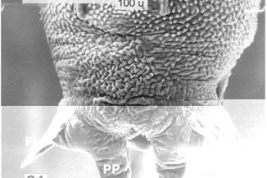 SEM female pupa caudal segment (dorsal view)