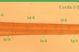 Larval siphon of Culex chidesteri (Photo: M. Laurito).