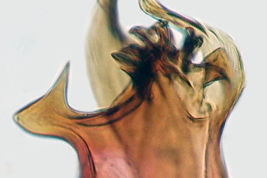 Hemiplaca lateral de macho de Culex dolosus (Lynch Arribálzaga) (Foto: M. Laurito).
