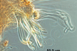 Lóbulo subapical de Culex intrincatus (Foto: G.C. Rossi).