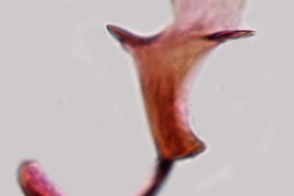 Esclerito aedeagal y placa lateral de Culex pavlovskyi  (Foto: M. Laurito).