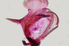 Esclerito aedeagal y placa lateral de Culex albinensis (Foto: M. Laurito).