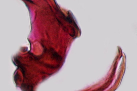 Esclerito aedeagal y placa lateral de Culex idottus (Foto: M. Laurito).