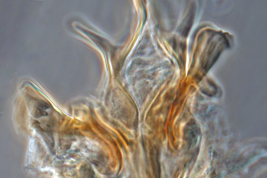 Esclerito aedeagal y placa lateral de Culex aliciae (Foto: G.C. Rossi).
