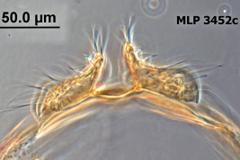 Tergum IX lobe of Culex aliciae (Photo: G.C. Rossi).