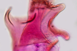 Hemi lateral plate of Culex saltanensis (Photo: M. Laurito).