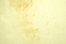 Exuvia larval de Culex maxi (Foto: M. Laurito).
