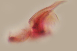 Esclerito aedeagal y placa lateral de Culex dunni (Foto: M. Laurito).