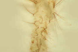 Exuvia larval de Culex mollis (Foto: M. Laurito).