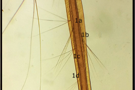 Larval siphon of Culex davisi (Photo: Stein et al. 2018).