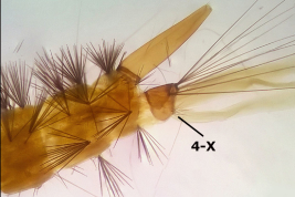 Segmentos abdominales terminales de la larva de Wyeomyia codiocampa (Foto: Stein et al. 2018).